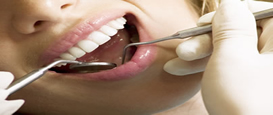 Casos de Restauração Estética, Clareamento Dental